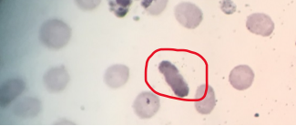 
							
								Microscope field with several cells visible. The circled cell is more opaque and elongated than the others. 
							
							